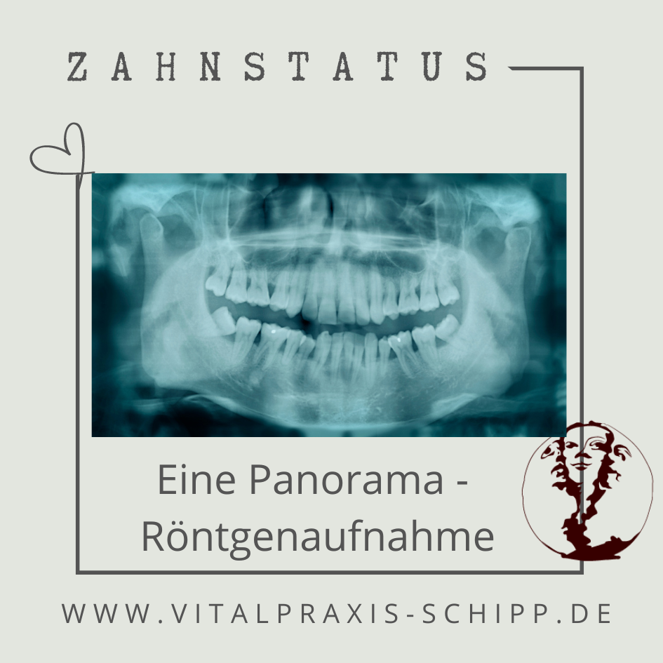 Panorama-Röntgenaufnahme für den Zahnstatus